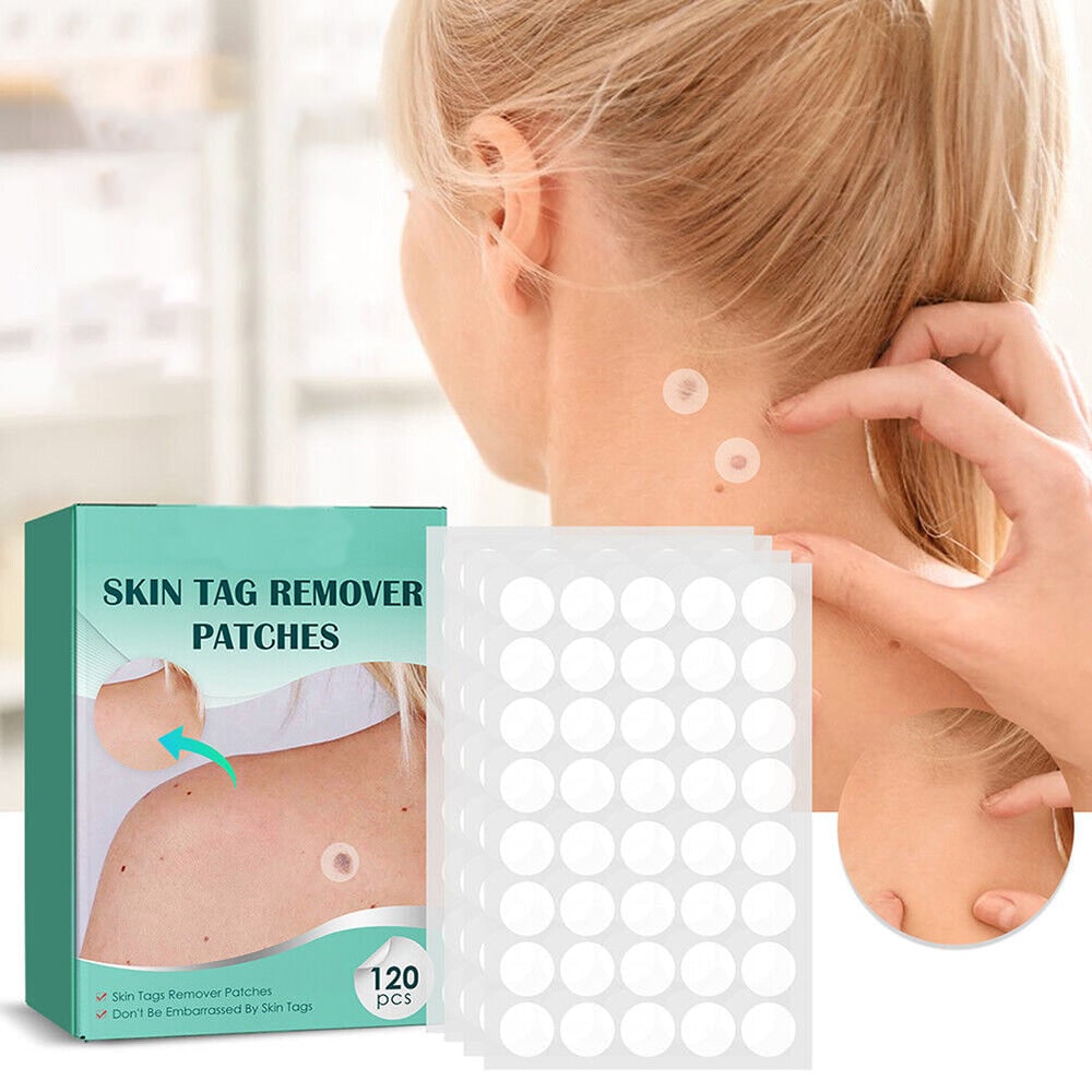 Hydrocolloid Skin Tag Patches