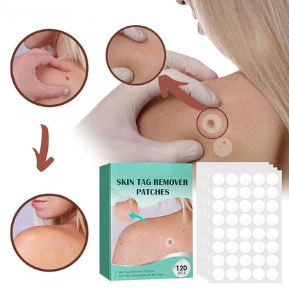 Hydrocolloid Skin Tag Patches